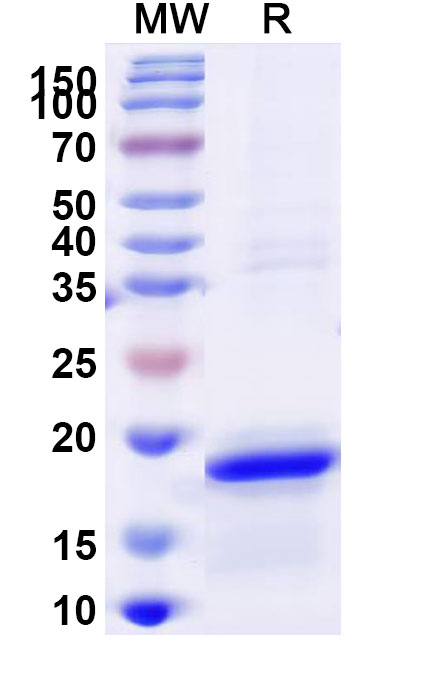 SDS-PAGE for Recombinant Human JAK3, N-His