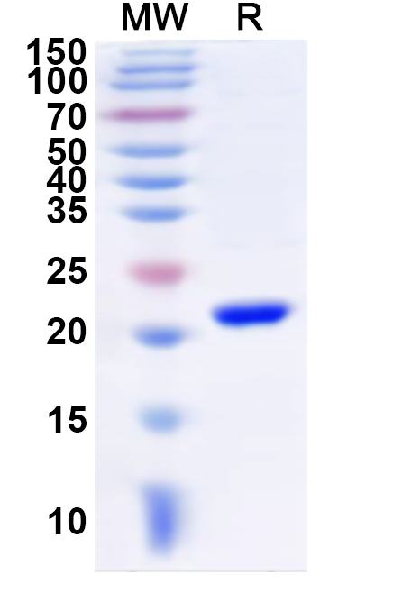 SDS-PAGE for Recombinant Human JOSD1 Protein, N-His