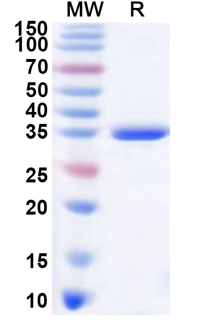 SDS-PAGE for Recombinant Human KAAG1 Protein, N-GST & C-His