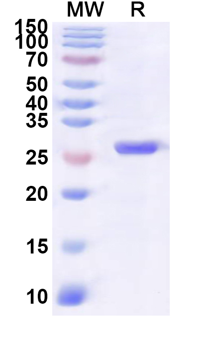 SDS-PAGE for Recombinant Human KANK1 Protein, N-His