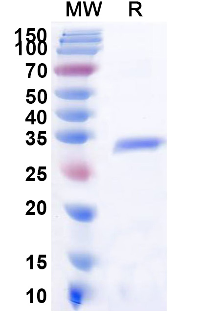 SDS-PAGE for Recombinant Human KAT7 Protein, N-His
