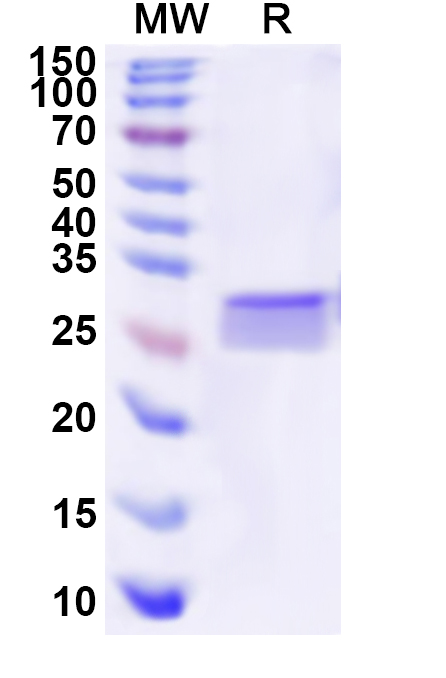 SDS-PAGE for Recombinant Human KCNJ1 Protein, N-His