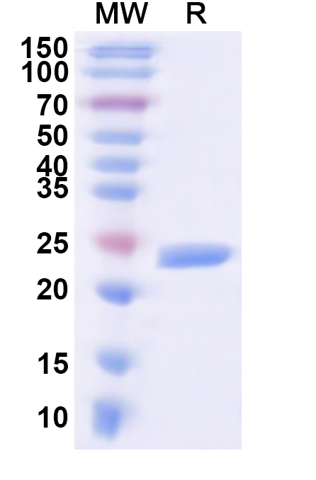 SDS-PAGE for Recombinant Human KCNJ5 Protein, N-His