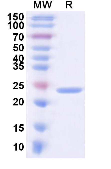 SDS-PAGE for Recombinant Human KCNJ6 Protein, N-His