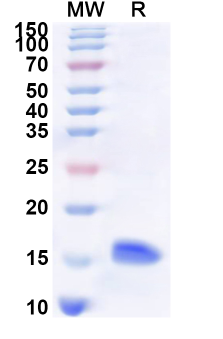 SDS-PAGE for Recombinant Human KCNMB1 Protein, N-His