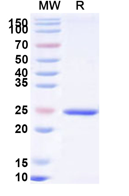 SDS-PAGE for Recombinant Human KCTD5 Protein, N-His