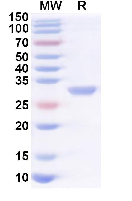 SDS-PAGE for Recombinant Human KDSR Protein, N-His