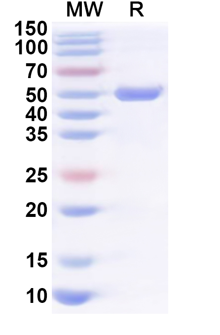 SDS-PAGE for Recombinant Human KIF23 Protein, N-His