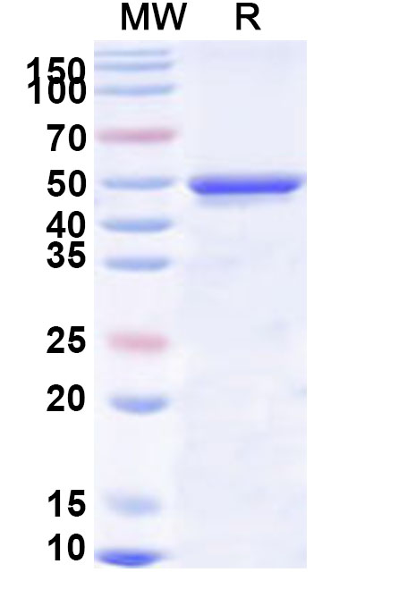 SDS-PAGE for Recombinant Human KIFC1 Protein, N-His