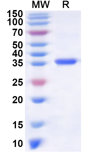 SDS-PAGE for Recombinant Human KLF9 Protein, N-His