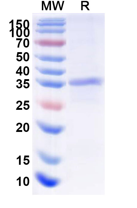 SDS-PAGE for Recombinant Human KLKB1 Protein, N-His
