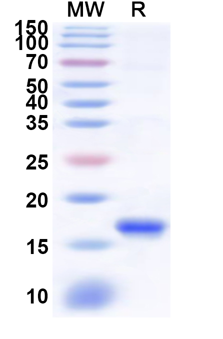 SDS-PAGE for Recombinant Human KLRC3 Protein, N-His