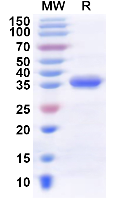 SDS-PAGE for Recombinant Human KMT5B Protein, N-His