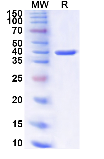 SDS-PAGE for Recombinant Human KRT32 Protein, N-His