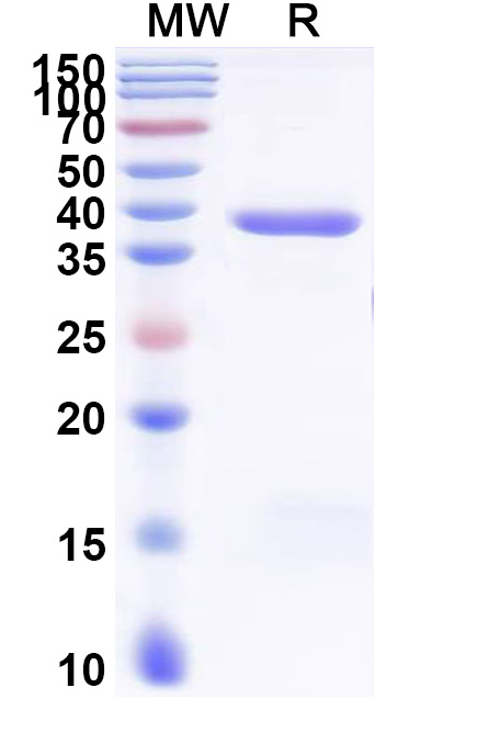 SDS-PAGE for Recombinant Human KRT33A, N-His