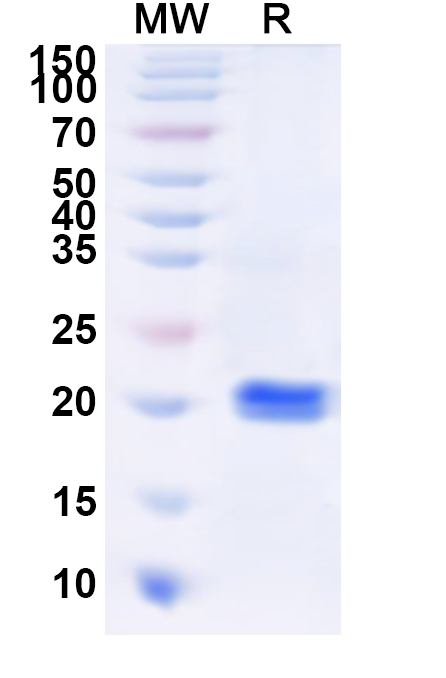 SDS-PAGE for Recombinant Human KRT39 Protein, N-His