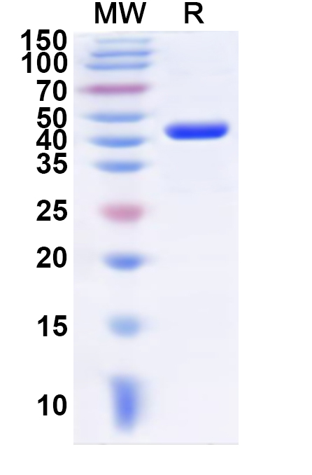 SDS-PAGE for Recombinant Human KRT72 Protein, N-His