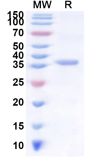 SDS-PAGE for Recombinant Human KRTAP13-2 Protein, N-His-KSI