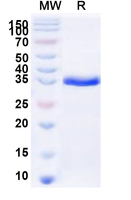 SDS-PAGE for Recombinant Human LAGE3 Protein, N-GST & C-His
