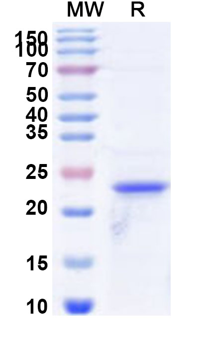 SDS-PAGE for Recombinant Human LAIR1 Protein, N-His