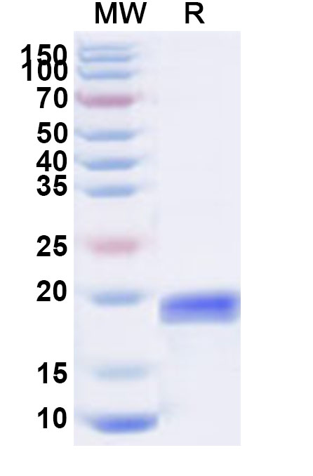 SDS-PAGE for Recombinant Human LAIR2 Protein, N-His