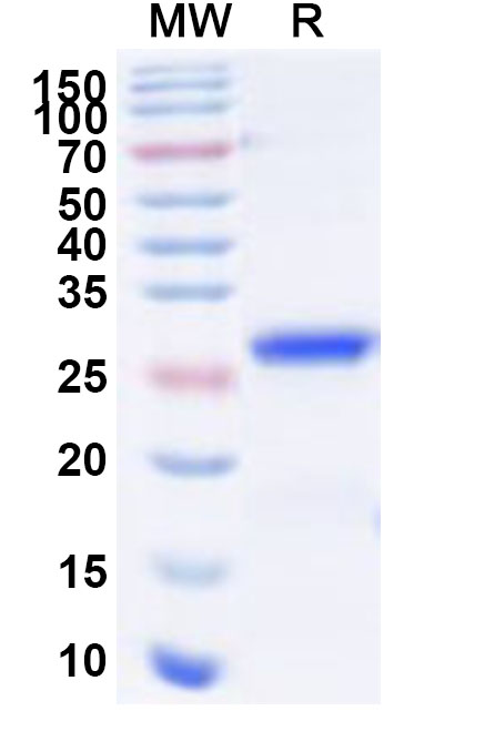 SDS-PAGE for Recombinant Human LAMA1 Protein, N-His