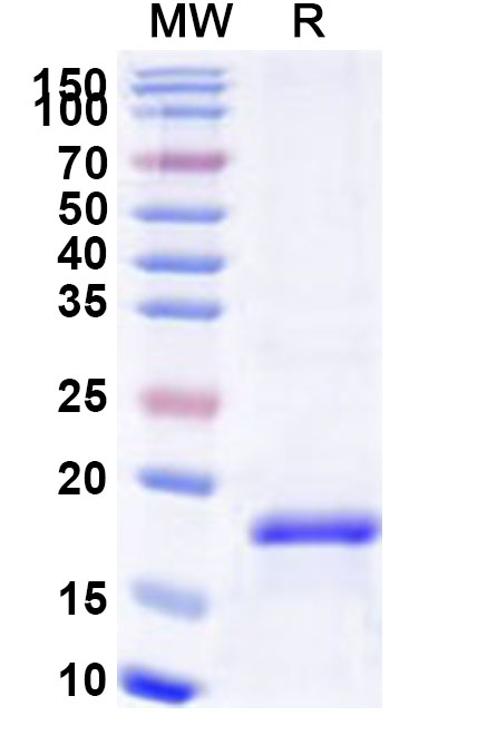 SDS-PAGE for Recombinant Human LAMP3 Protein, N-His