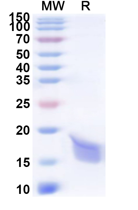SDS-PAGE for Recombinant Human LAMTOR4 Protein, N-His
