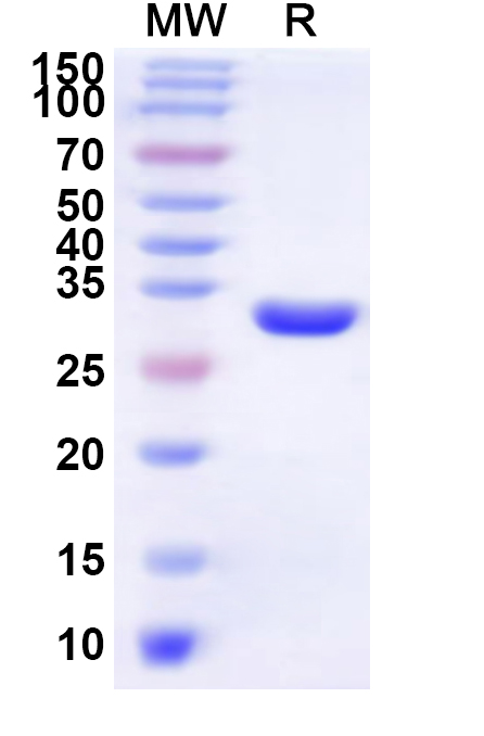 SDS-PAGE for Recombinant Human LBH Protein, N-His-KSI