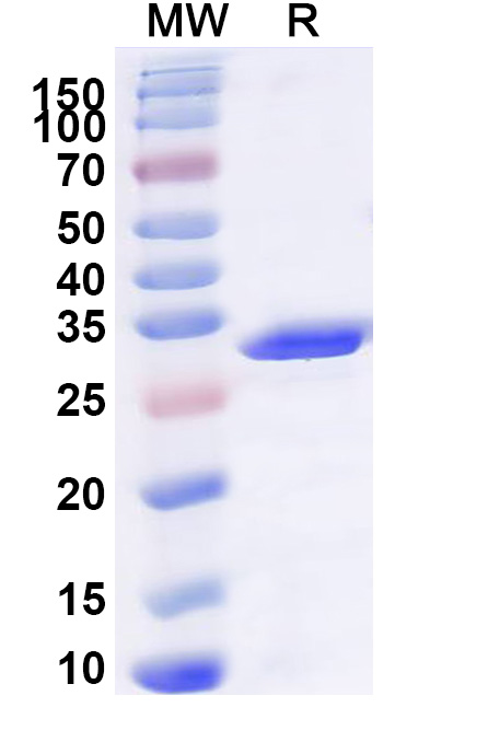 SDS-PAGE for Recombinant Human LBR Protein, N-GST & C-His