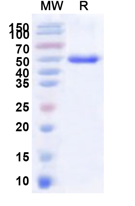 SDS-PAGE for Recombinant Human LBX1 Protein, N-His-KSI