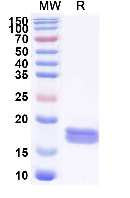 SDS-PAGE for Recombinant Human LC3B/MAP1LC3B Protein, N-His