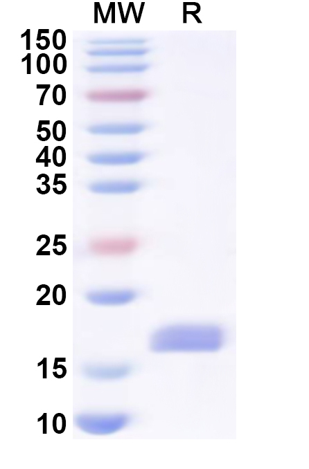 SDS-PAGE for Recombinant Human LCP2 Protein, N-His