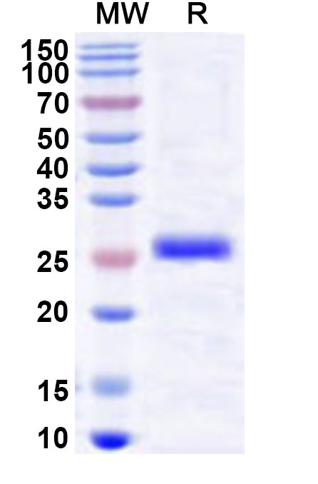 SDS-PAGE for Recombinant Human LDB3 Protein, N-His