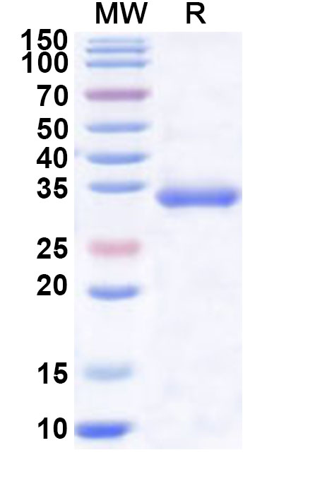 SDS-PAGE for Recombinant Human LDHC Protein, N-His