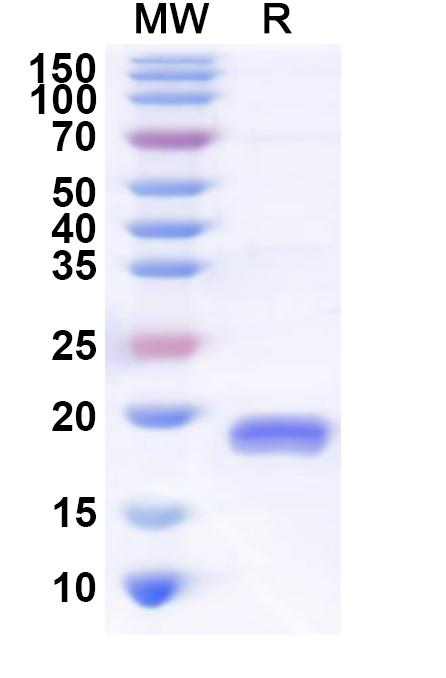SDS-PAGE for Recombinant Human LDLRAP1 Protein, N-His