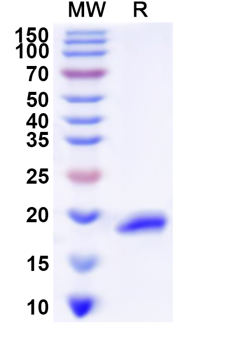 SDS-PAGE for Recombinant Human LHX1 Protein, N-His
