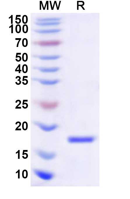 SDS-PAGE for Recombinant Human LHX2 Protein, N-His