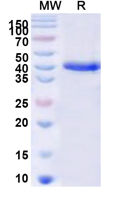 SDS-PAGE for Recombinant Human LIPN Protein, N-His