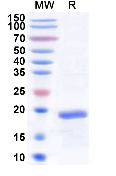 SDS-PAGE for Recombinant Human LMO1 Protein, N-His