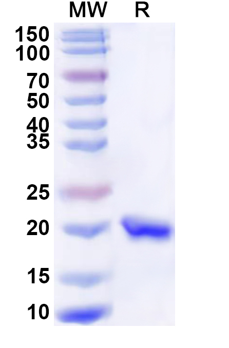 SDS-PAGE for Recombinant Human LMO2 Protein, N-His