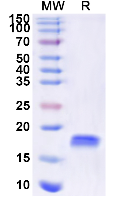 SDS-PAGE for Recombinant Human LMO4 Protein, N-His
