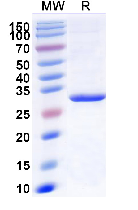 SDS-PAGE for Recombinant Human LPL, N-His