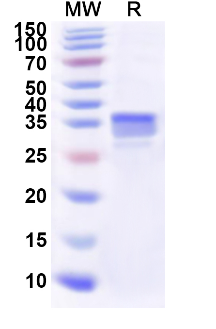 SDS-PAGE for Recombinant Human LSM6 Protein, N-GST & C-His