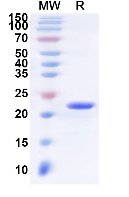 SDS-PAGE for Recombinant Human LTB4R Protein, N-His-KSI