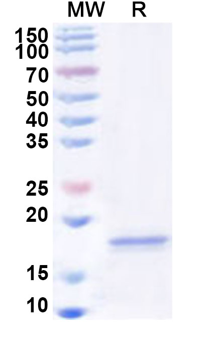 SDS-PAGE for Recombinant Human LY86 Protein, N-His