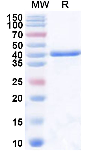 SDS-PAGE for Recombinant Human MAN2A1 Protein, N-His