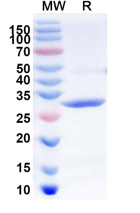 SDS-PAGE for Recombinant Human MAP3K11 Protein, N-His
