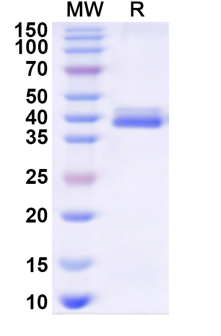 SDS-PAGE for Recombinant Human MAP3K14 Protein, N-His