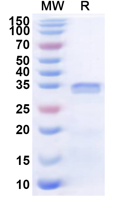 SDS-PAGE for Recombinant Human MAP3K21 Protein, N-His